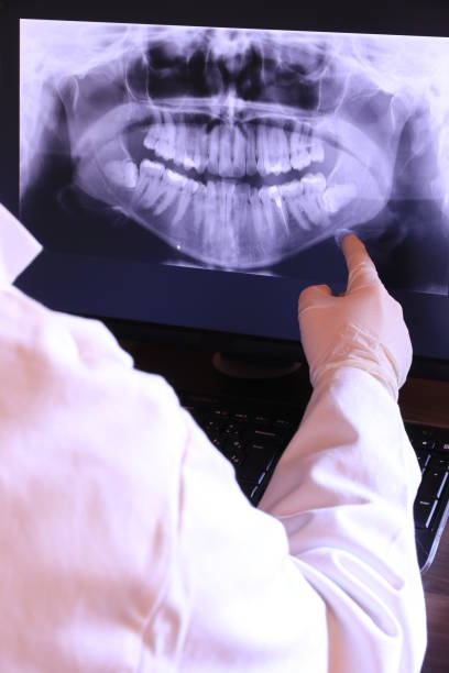 Best Emergency Denture Repair in Buhler, KS