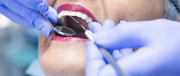 Best Emergency Root Canal Therapy in Buhler, KS